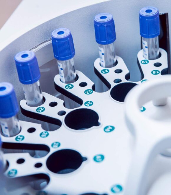 End-to-End IVD CDMO Solutions