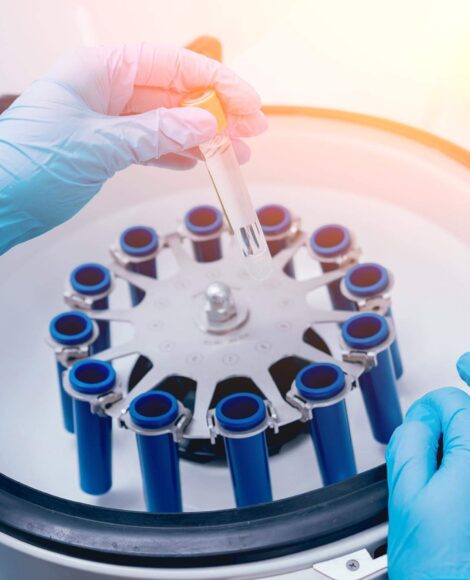 End-to-End IVD CDMO Solutions