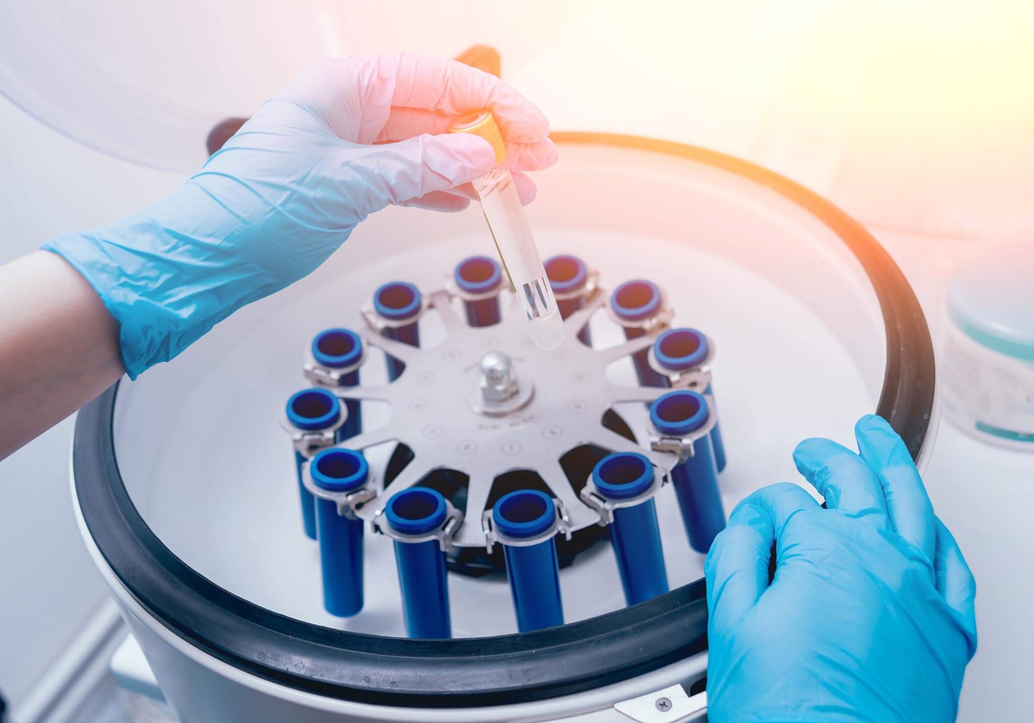 IVDCDMO | One-Stop In Vitro Diagnostics ( IVD ) CDMO Services