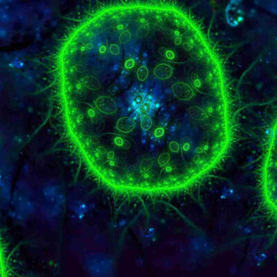 CLIA Platform Chemiluminescence Immunoassay
